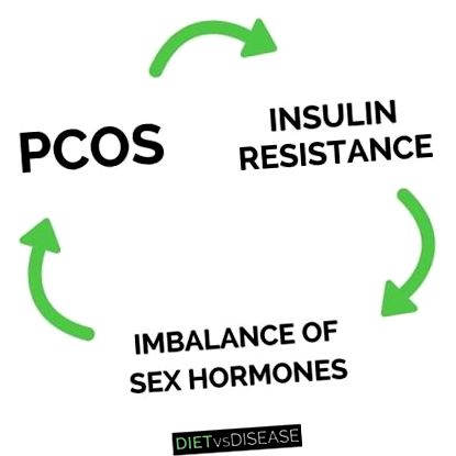 pcos