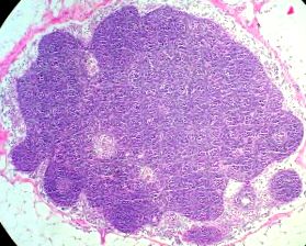 Mycobacterium tuberculosis