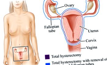 abdominală