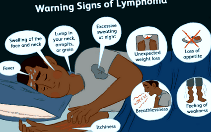 симптоми