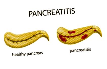 панкреатит може