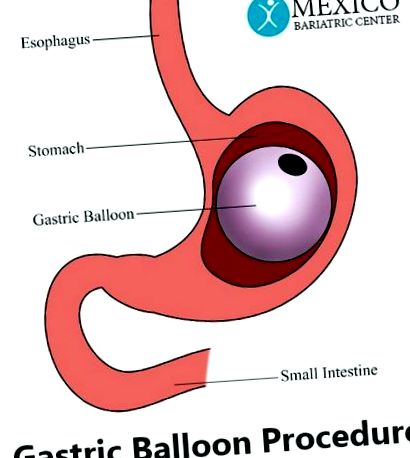 gastric