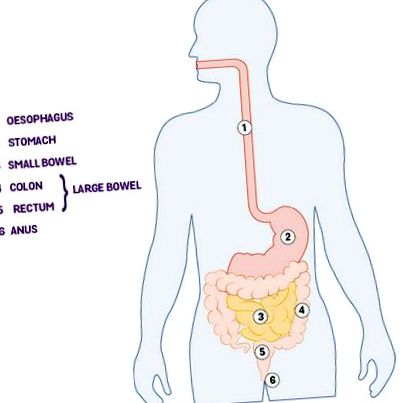 crohn