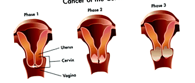 cervicală