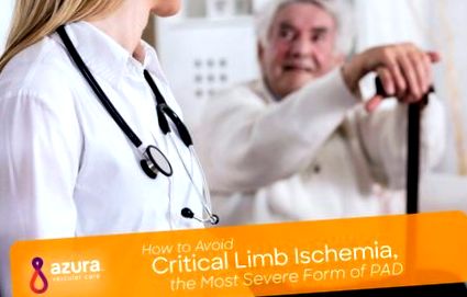 ischemia