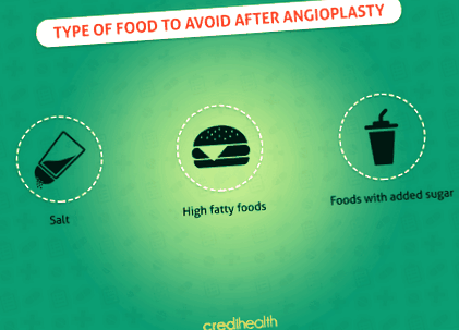 angioplastie