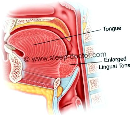 linguală