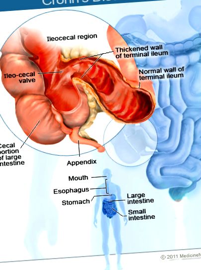 gastroenterology