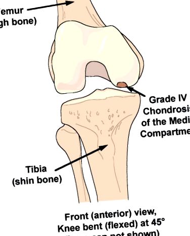 medial