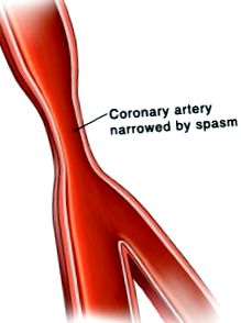 arterelor coronare