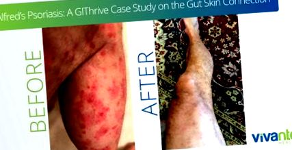 gut-skin