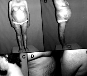 таблиця поширеність