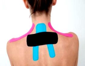 kinesio-tape