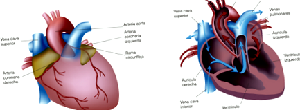 angina