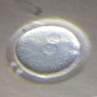 embrionális