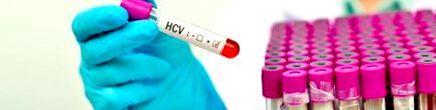 Hepatitis vírus