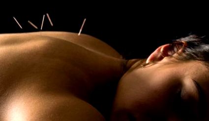 akupunktúrát
