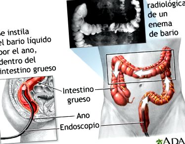 Medical Encyclopedia