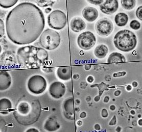 blastocystis