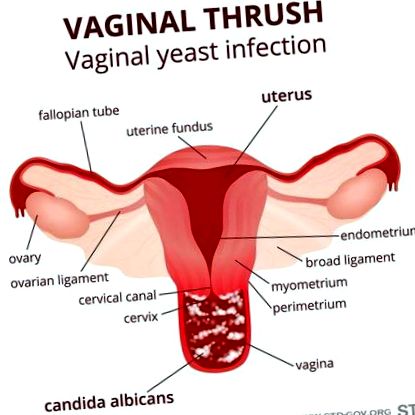 vaginale