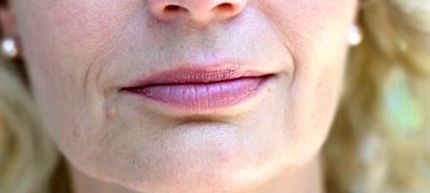 Cum de a ascunde ridurile de pe părțile laterale ale nasului