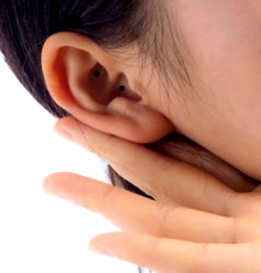 Cauzele cosului la nivelul urechii și modul de tratare eficientă a IFSS