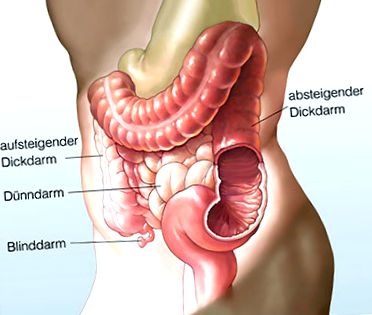 Cauze și simptome ale cancerului de colon