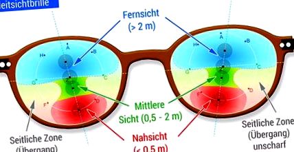 Közeli látótávolság, Lézeres látáskorrekció távoli látótávolság és astigmatizmus