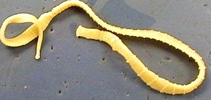 férgek petéi trágyáig paraziták az emberi testben az ascariasis kezelésében