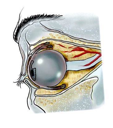 látóideg gyulladás kezelése a szemek fájnak, a látás elvész