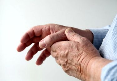 Rheumatoid arthritis Ujj fájdalom index ízület