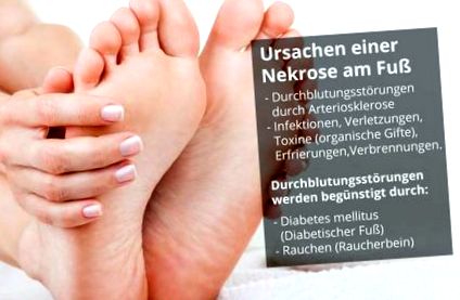 fájdalom a lábak diabetes mellitus népi kezelés sah diabetes