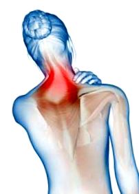 Nyakfájás: ha görcsöl a nyaka a fájdalomtól, így enyhítheti