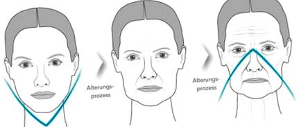 tratament riduri obraji când apar riduri pe frunte