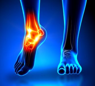 a bokaízület 1 szakaszának deformáló artrózisa
