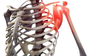 fájdalomcsillapítás a vállízület osteoarthritisében