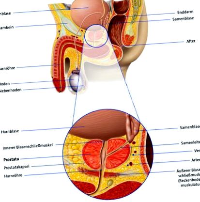 Ízületi fájdalom prosztata adenómával. A prosztatagyulladás tünetei | BENU Gyógyszertárak
