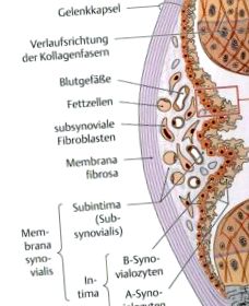 reaktív arthrosis a gerinc hátsó részének osteochondrosisa