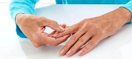 Osteoarthritis tünetek és otthoni kezelés. Hogyan kell kezelni az arthrosist otthon