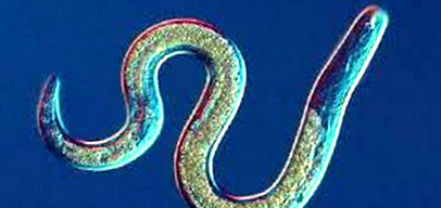 agenți antiparazitari pentru viermi cum să froti condiloamele în locuri intime