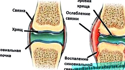 лікування