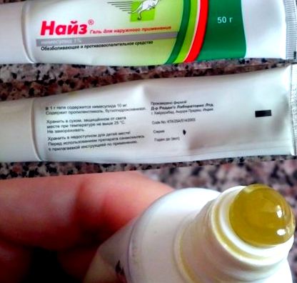 Лечение на остеоартрит на акромиоклавикуларна става, Най-добрите ...