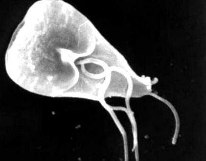 giardia