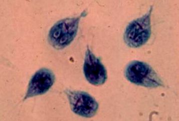 giardia