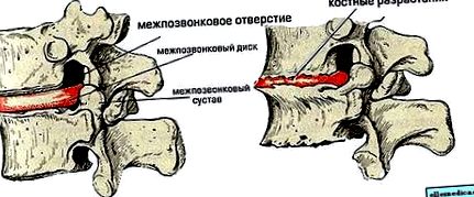 яких