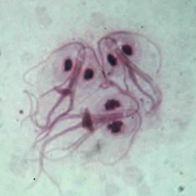 giardiasis