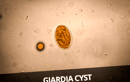 giardia