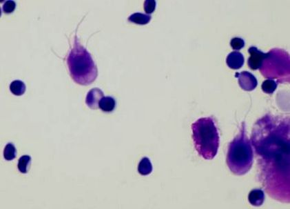 bacteria giardia sintomas paraziták tünetei a felnőtt testében