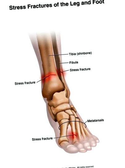 izomfájdalom a láb alsó lábainak ízületében