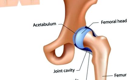 csípő coxarthrosis kezelés osteoarthrosis izületi fájdalmak ampullákban